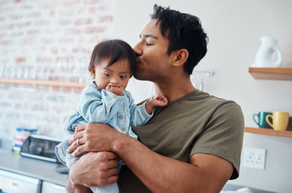 Young Asian father kisses his infant daughter with Down Syndrome.